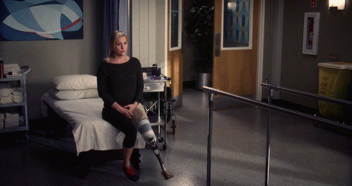 Arizona Robbins with a prosthetic leg